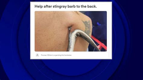 Woman Speaks Out After Being ‘impaled By Stingray In Florida Good