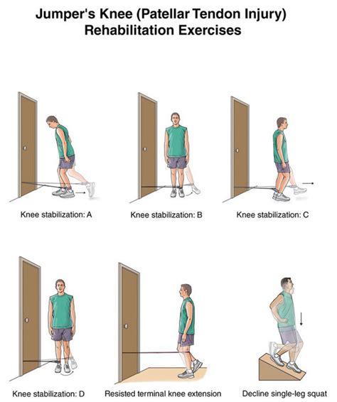 Patellar Tendinitis Causes Symptoms Stretching Exercises Treatments