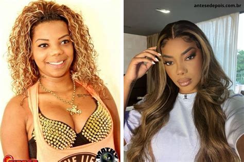 Ludmilla Antes E Depois Da Cantora Ap S Cirurgias