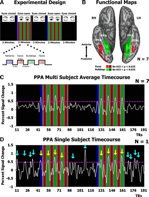 Figure 1 From Widespread Functional Connectivity And FMRI Fluctuations