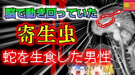 【2017年中国】突然気絶して痙攣を始めた男性 脳から10cm以上ある生きた寄生虫が発見される『マンソン裂頭条虫症』【ゆっくり解説