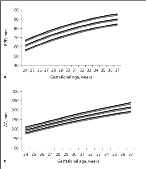 Figure 1 From Gender Specific Antenatal Growth Reference Charts In