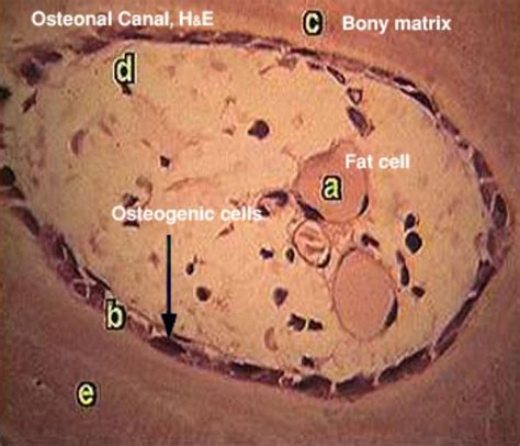 connective tissue bone