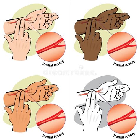 Primeros Auxilios Para Medir El Pulso A Trav S De La Arteria Car Tida