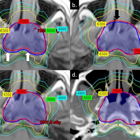 Axial Ct And Mri Red View Of Acr Phantom At Magnet Isocenter A Download Scientific Diagram