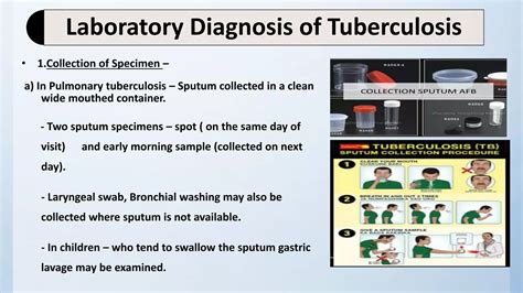 Laboratory Diagnosis Of Tuberculosis Pract PPT