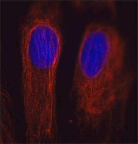 Anti Vimentin Antibody Mouse Monoclonal