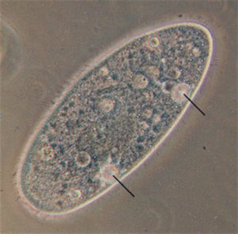 Contractile Vacuole | Definition, Function & Examples - Lesson | Study.com