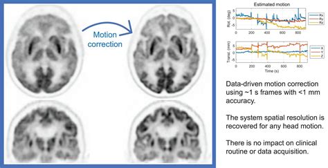 Evaluation Of Data Driven Rigid Motion Correction In Clinical Brain Pet