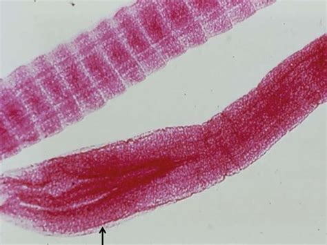 Cestodes Flashcards Quizlet