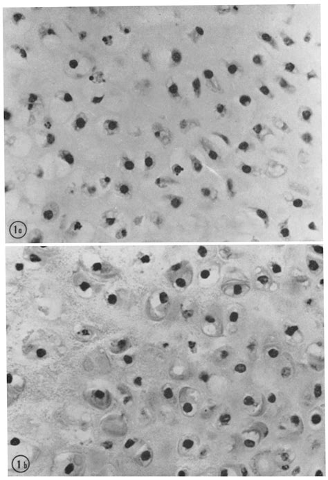 A 17 Day Mouse Femur 7 Days In Lysozyme Free Medium Resting