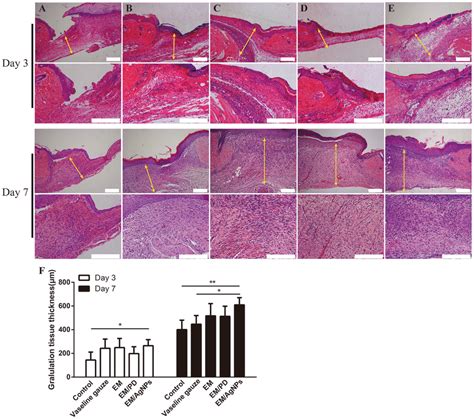 The Effect Of Em Agnps On Granulation Tissue Formation Representative Download Scientific