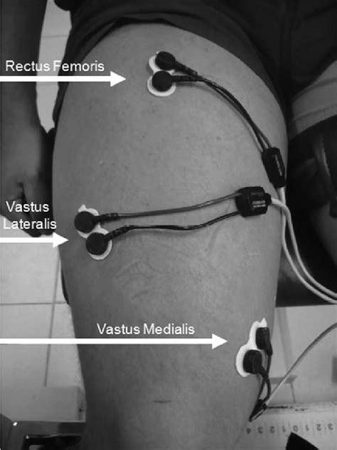 Position Of The Surface Electrodes On The Vastus Medialis Vastus