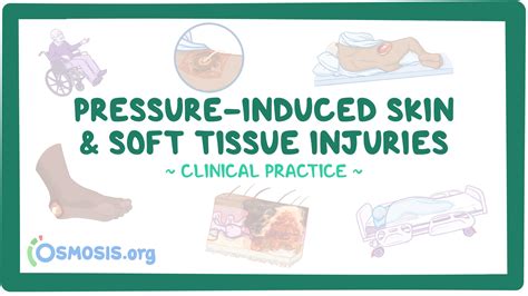 Pressure Induced Skin And Soft Tissue Injury Video Meaning Osmosis