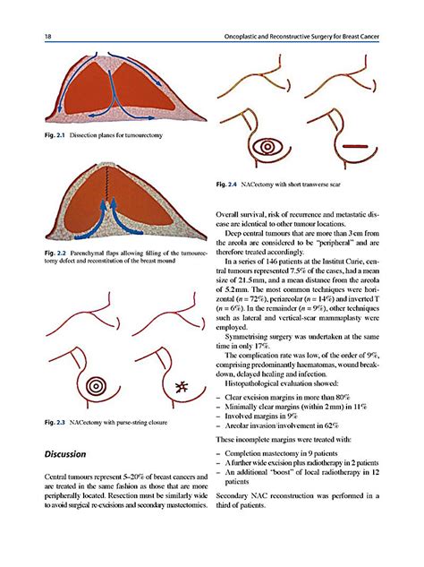 Oncoplastic And Reconstructive Surgery For Breast Cancer Buch