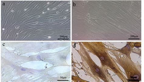 The Characterization Of Bmscs And The Induced Cells The Third