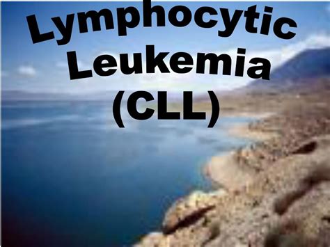 Ppt Chronic Lymphocytic Leukemia Cll Powerpoint Presentation Free