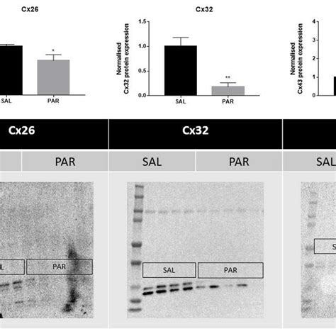 Effects of acute liver disease on protein levels of hepatic cell ...