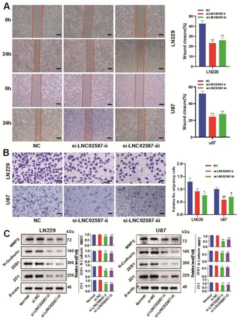 Linc Silencing Inhibits Glioma Invasion And Migration A