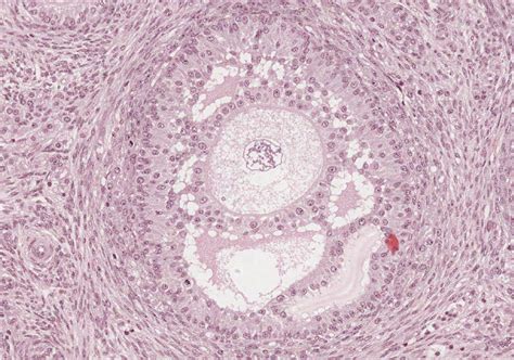 Lab 11 Histology Ovary Secondary Follicle Diagram Quizlet