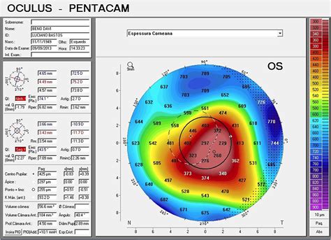 Contact Lens Spectrum PentaVision