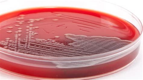 Escherichia Coli Bacteria On Columbia Blood Agar Stock Photo Image