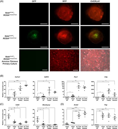 Analysis Of Cell Phenotype In Primary Annulus Fibrosus AF Cell