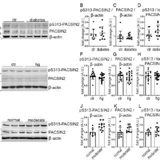 The Phosphorylation Of Pacsin At S Associates With Renal Impairment