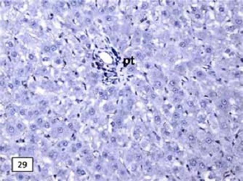 A Photomicrograph Of A Liver Section Of An Adult Albino Rat Group I