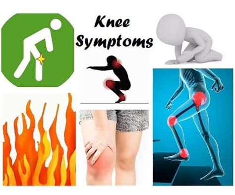 Knee Pain Symptoms And Signs