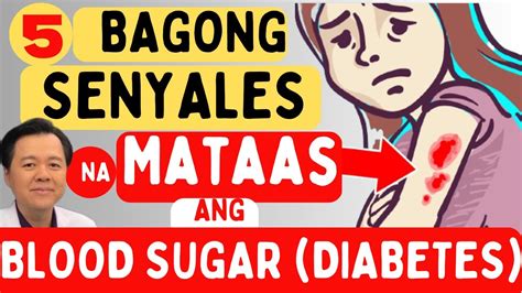 5 Bagong Senyales Na Mataas Ang Blood Sugar Diabetes By Doc Willie