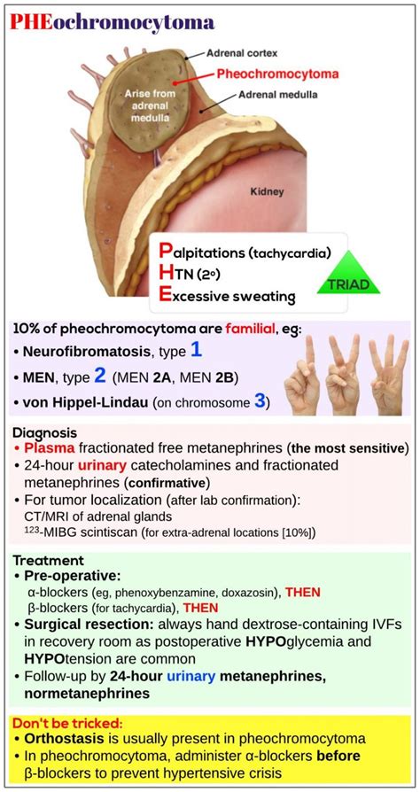 Pheochromocytoma Medicine Keys For Mrcps