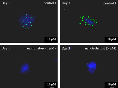 Poly Trehalose Nanoparticles Prevent Amyloid Aggregation And Suppress