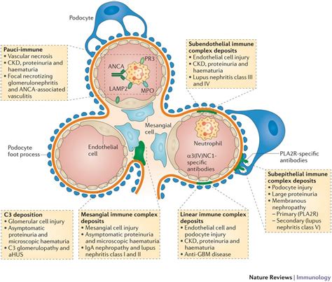 What Is A Microscopic Haematuria - Ferdinand Husband Bruidstaart