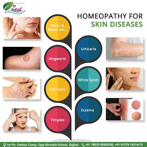 Think For Homeopathy Medicines By Dr Nirali Vaidya Kothari For Your