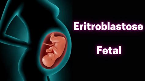 Eritroblastose Fetaldoença Hemolítica Do Recém Nascido Fisiologia