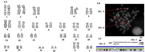 Conventional And Molecular Cytogenetic Analysis Of Case 2 A Gtg Download Scientific Diagram