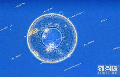 Arcella Sp Amoeba Rhizopoda Protozoans Optic Microscopy Stock