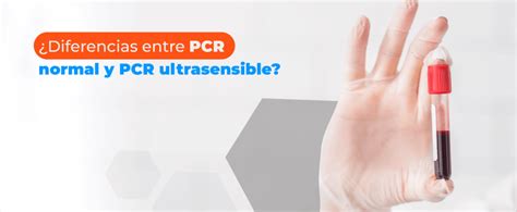 DIFERENCIA ENTRE PCR ULTRASENSIBLE Y PCR Laboratorios Páez