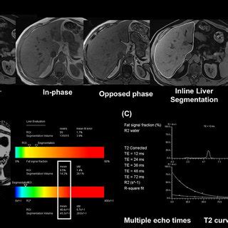 Hepatic Steatosis Techniques Using Mri Pdff And Mr Spectroscopy A T