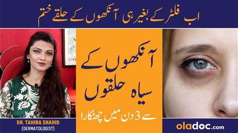 Aankhon Ke Halke Khatam Karne Ka Tarika Dark Circles Treatment