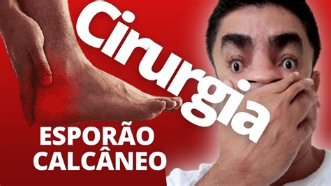 Cirurgia Do Espor O Calc Neo E Fasceite Plantar Dor No Calcanhar Youtube