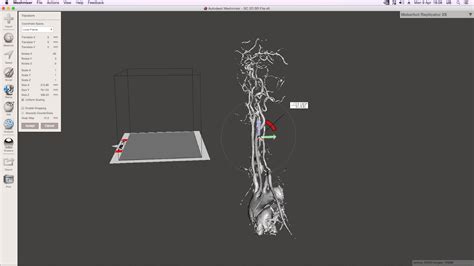 Nevit's blog: Creating 3D STL files for 3D printing from MRA using ...