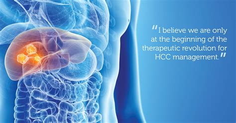 Hepatocellular Carcinoma Hope On The Horizon