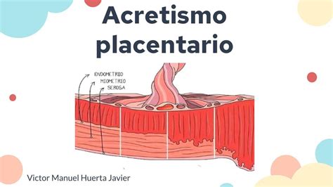 Acretismo Placentario Victor M Huerta UDocz