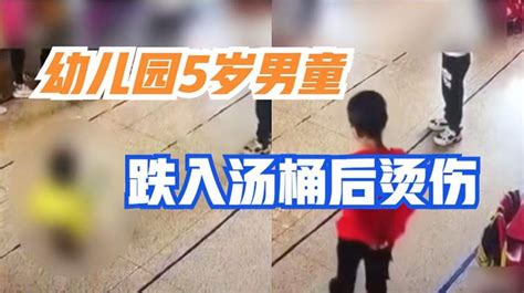 福建：幼儿园5岁男童玩耍时跌入汤桶，起身后滑倒，全身多处烫伤 社会 民生 好看视频