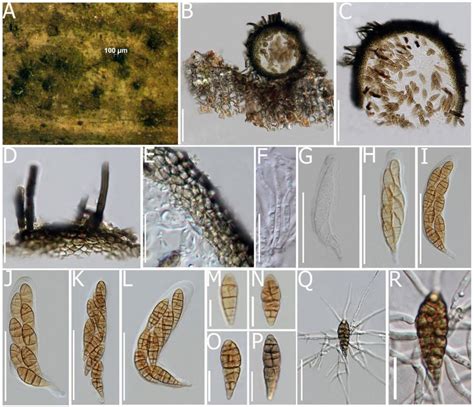 Clavatispora Thailandica Mflu 18 0710 Sexual Morph A Appearance Of