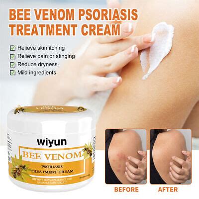 Bee Venom Psoriasis Relief Cream Dermatitis Eczema Healing