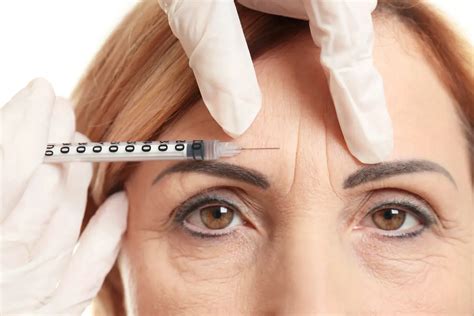 Botox 8 Dicas Que Você Precisa Saber