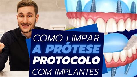 Como Limpar Prótese Protocolo Sobre Implantes Heal Odontologia YouTube